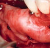 Preview: Master Pin Control Basic