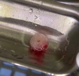 Preview: Transfer-Ring-Control I