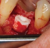 Preview: Transfer-Ring-Control II