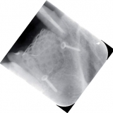 Screw-System TX