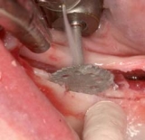 Preview: Saw Basic Kit