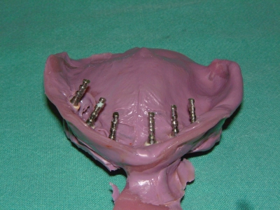 Laboranalog (2 Stück)