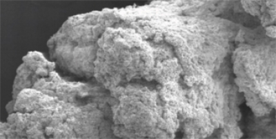 NanoBone® Granulat fein 5 x 2,4 ml